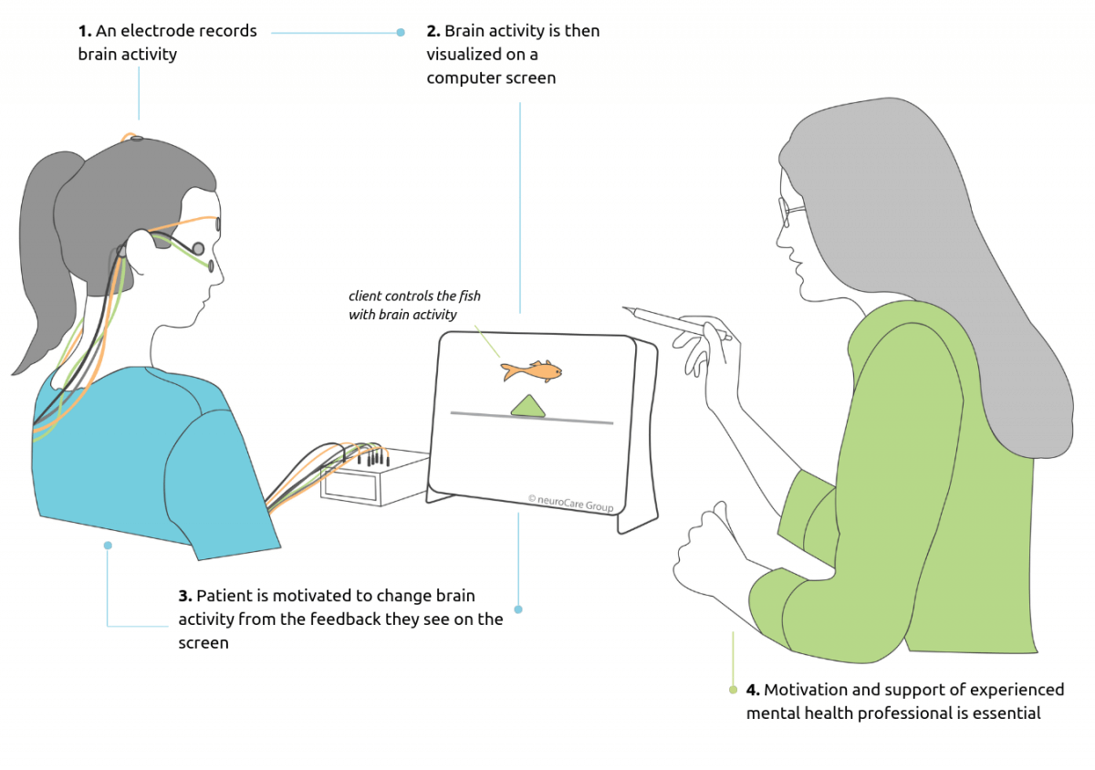 Neurofeedback-Explanation-Graphic