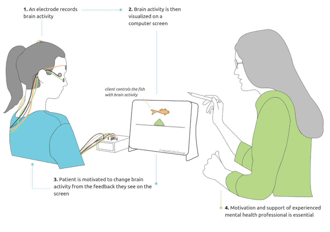 What is Neurofeedback?