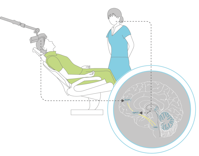 Cost of TMS is found to be more effective as compared to traditional medication management