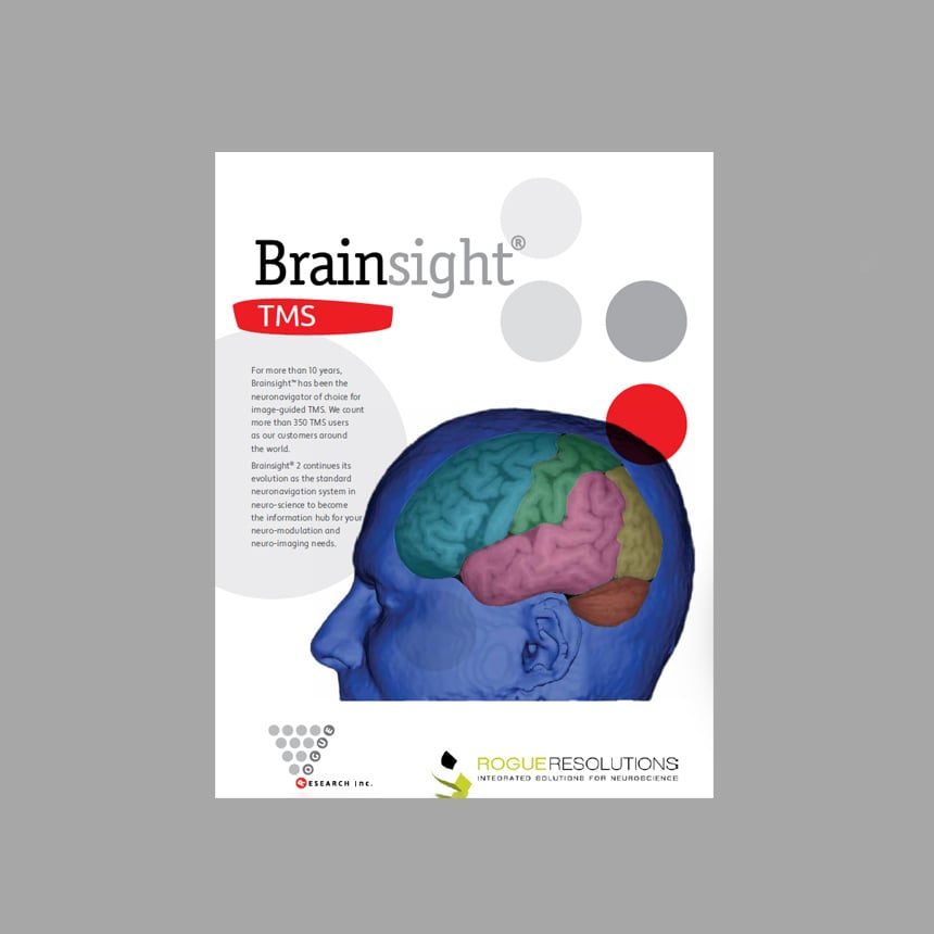 thumbnail_A4_Brainsight_TMS