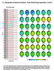 products_NEURO-LAB_QEEGreport