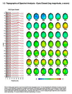 products_NEURO-LAB_QEEGreport