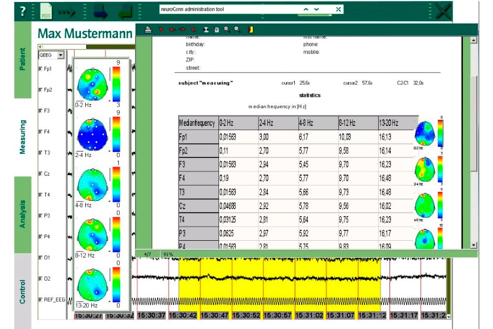 products_NEURO_PRAX_EEG_6