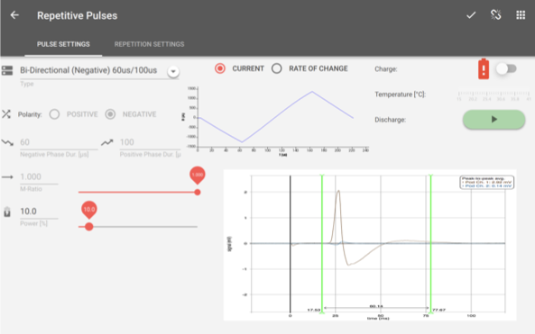 neuroConn-Brainsight-cTMS-user-interface_1