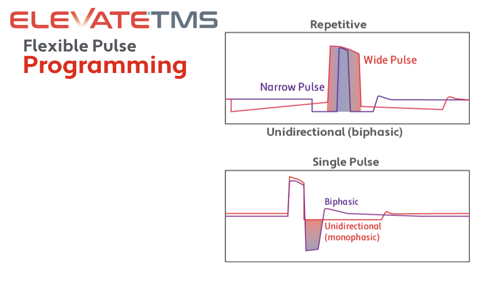 neuroConn-Brainsight-cTMS-flexible-pulse-programming