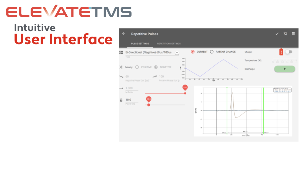 neuroConn-Brainsight-cTMS-user-interface