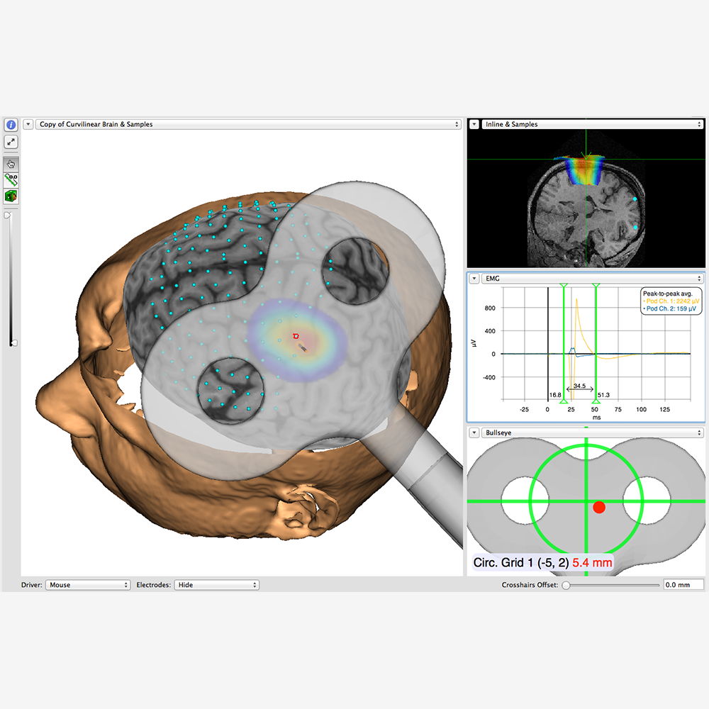 neuronavigation_screen_grey