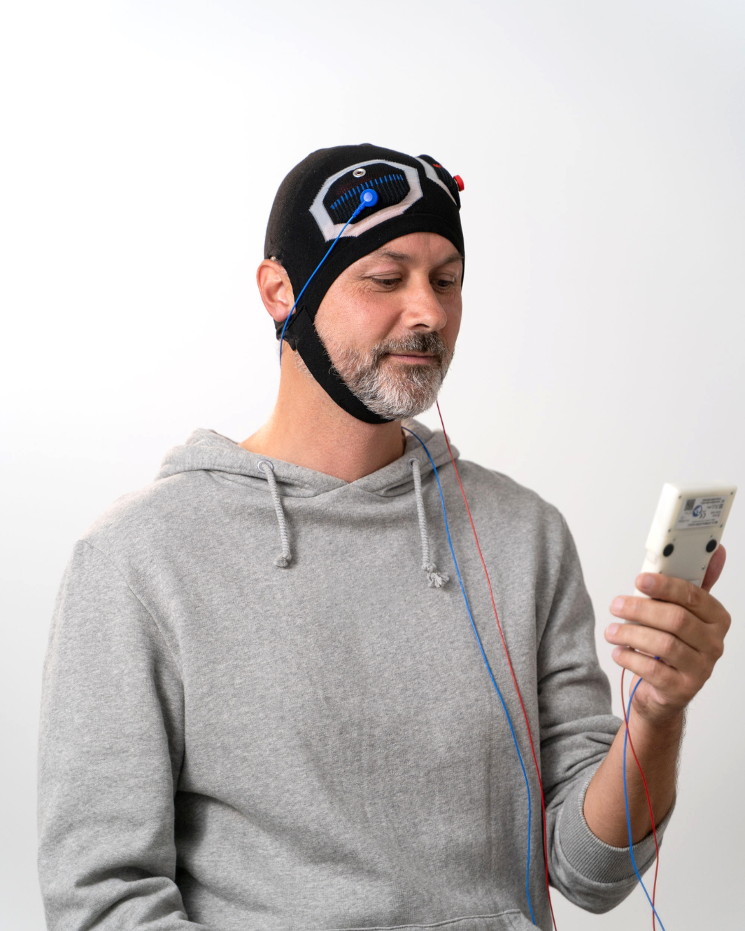 tDCS